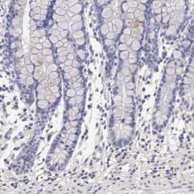 Immunohistochemistry-Paraffin: ER alpha/NR3A1 Antibody [NBP1-84827]