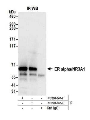 Immunoprecipitation: ER alpha/NR3A1 Antibody [NB200-347]