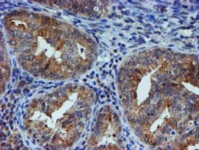 Immunohistochemistry: ER alpha/NR3A1 Antibody (OTI1B1) - Azide and BSA Free [NBP2-70687]