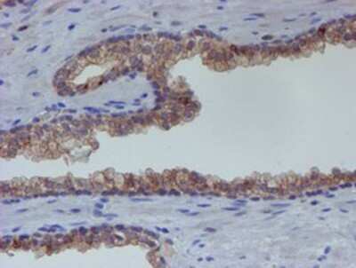 Immunohistochemistry: ER alpha/NR3A1 Antibody (OTI1B1) - Azide and BSA Free [NBP2-70687]