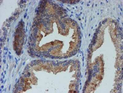 Immunohistochemistry: ER alpha/NR3A1 Antibody (OTI1B1) - Azide and BSA Free [NBP2-70687]