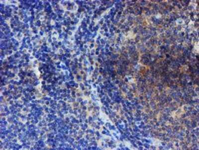 Immunohistochemistry: ER alpha/NR3A1 Antibody (OTI1B1) - Azide and BSA Free [NBP2-70687]
