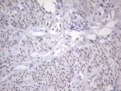 Immunohistochemistry: ER alpha/NR3A1 Antibody (OTI2D3) - Azide and BSA Free [NBP2-70688]