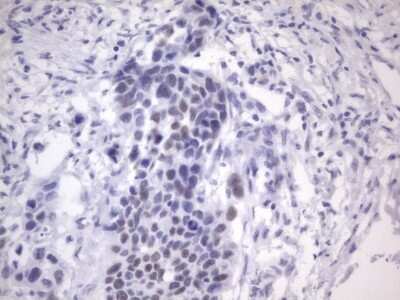 Immunohistochemistry: ER alpha/NR3A1 Antibody (OTI2D3) - Azide and BSA Free [NBP2-70688]