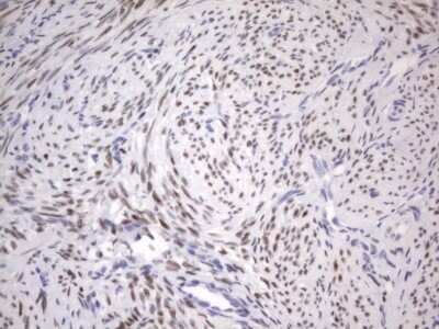 Immunohistochemistry: ER alpha/NR3A1 Antibody (OTI2D3) - Azide and BSA Free [NBP2-70688]