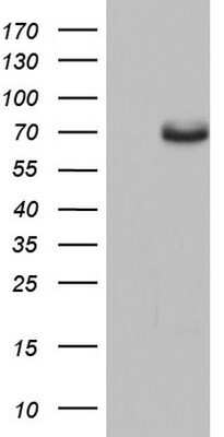 Western Blot: ER alpha/NR3A1 Antibody (OTI2D3)Azide and BSA Free [NBP2-70688]