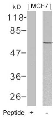 Western Blot: ER alpha/NR3A1 Antibody [NB100-81909]