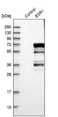 Western Blot: ER alpha/NR3A1 Antibody [NBP1-84826]