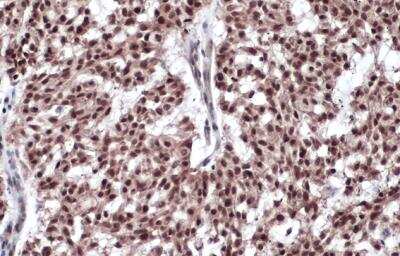 Immunohistochemistry-Paraffin: ER beta/NR3A2 Antibody (14C8) [NB200-305]