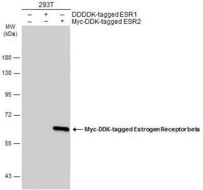 Western Blot: ER beta/NR3A2 Antibody (14C8) [NB200-305]