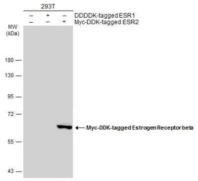 Western Blot: ER beta/NR3A2 Antibody (6A12) [NB200-303]