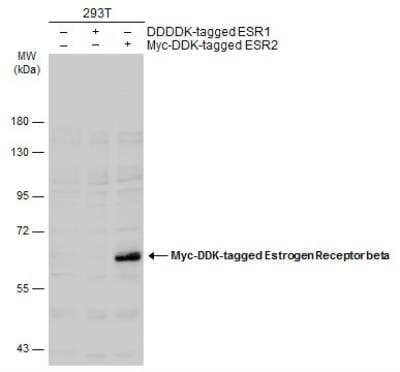 Western Blot: ER beta/NR3A2 Antibody (6B12) [NB200-304]