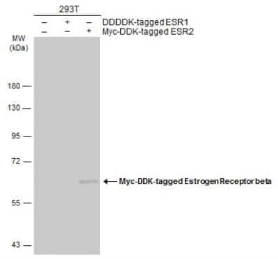 Western Blot: ER beta/NR3A2 Antibody (7B10.7) [NBP1-41194]