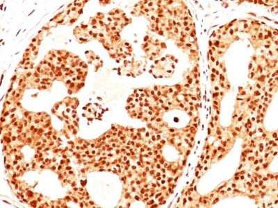 Immunohistochemistry-Paraffin: ER beta/NR3A2 Antibody (ERb455) - Azide and BSA Free [NBP2-33066]
