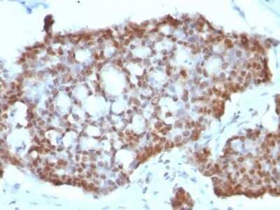 Immunohistochemistry-Paraffin: ER beta/NR3A2 Antibody (ERb455) - IHC-Prediluted [NBP2-44365]
