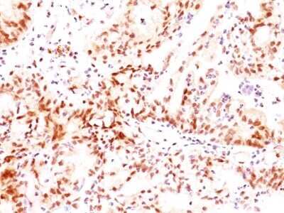 Immunohistochemistry-Paraffin: ER beta/NR3A2 Antibody (ERb455) - IHC-Prediluted [NBP2-44365]