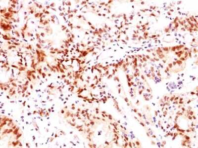 Immunohistochemistry-Paraffin: ER beta/NR3A2 Antibody (ERb455) [NBP2-29439]