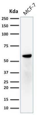 Western Blot: ER beta/NR3A2 Antibody (ERb455) [NBP2-29439]