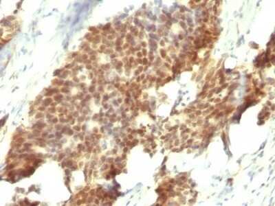 Immunohistochemistry-Paraffin: ER beta/NR3A2 Antibody (ESR2/686) - Azide and BSA Free [NBP2-47797]