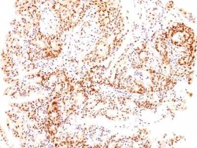 Immunohistochemistry-Paraffin: ER beta/NR3A2 Antibody (ESR2/686) - Azide and BSA Free [NBP2-47797]