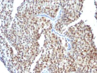 Immunohistochemistry-Paraffin: ER beta/NR3A2 Antibody (ESR2/686) - IHC-Prediluted [NBP2-48309]