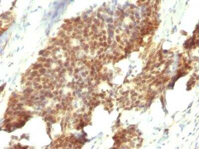 Immunohistochemistry-Paraffin: ER beta/NR3A2 Antibody (ESR2/686) - IHC-Prediluted [NBP2-48309]