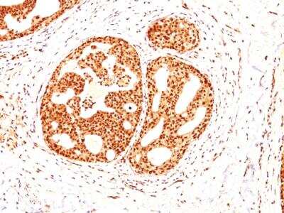 Immunohistochemistry-Paraffin: ER beta/NR3A2 Antibody (ESR2/686) - IHC-Prediluted [NBP2-48309]