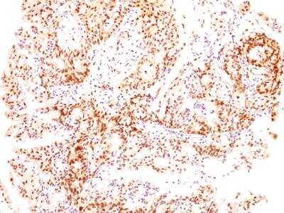 Immunohistochemistry-Paraffin: ER beta/NR3A2 Antibody (ESR2/686) - IHC-Prediluted [NBP2-48309]