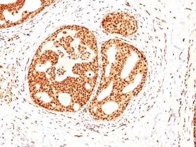 Immunohistochemistry-Paraffin: ER beta/NR3A2 Antibody (ESR2/686) [NBP2-44366]