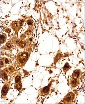 Immunohistochemistry-Paraffin: ER beta/NR3A2 Antibody - BSA Free [NBP2-81132]