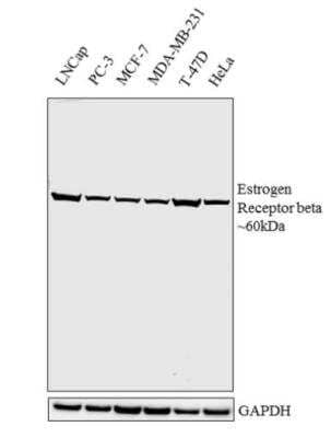 Western Blot: ER beta/NR3A2 Antibody [NB120-3577]