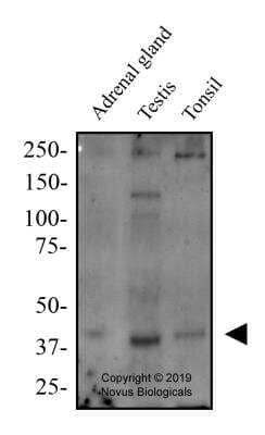 Western Blot: ER beta/NR3A2 AntibodyBSA Free [NBP2-81132]