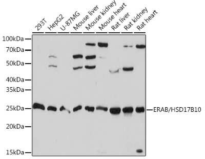 Western Blot: ERAB Antibody (3O4W10) [NBP3-15327]