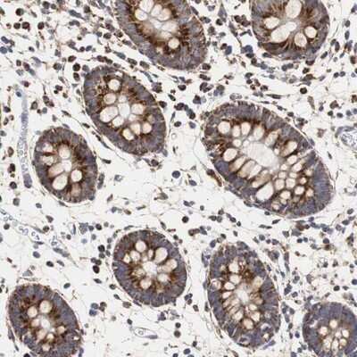 Immunohistochemistry-Paraffin: ERAB Antibody [NBP1-90333]