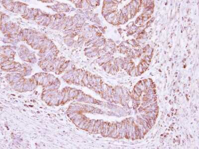 Immunohistochemistry-Paraffin: ERAB Antibody [NBP2-16360]