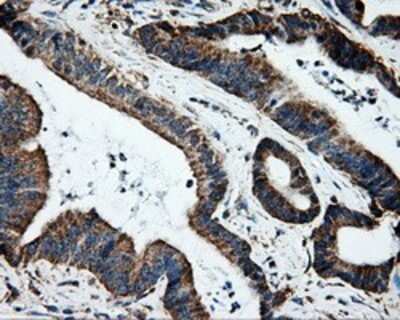 Immunohistochemistry: ERAB Antibody (OTI10B4) - Azide and BSA Free [NBP2-70871]