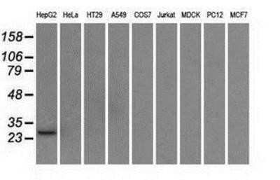 Western Blot: ERAB Antibody (OTI10B4)Azide and BSA Free [NBP2-70871]