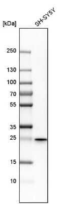 Western Blot: ERAB Antibody [NBP1-90333]