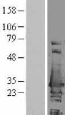 Western Blot: ERAB Overexpression Lysate [NBL1-11722]