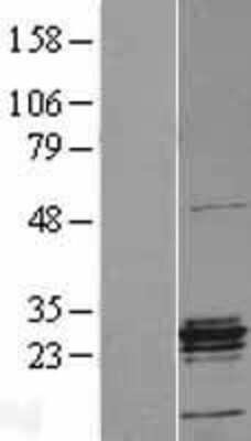 Western Blot: ERAB Overexpression Lysate [NBL1-11723]