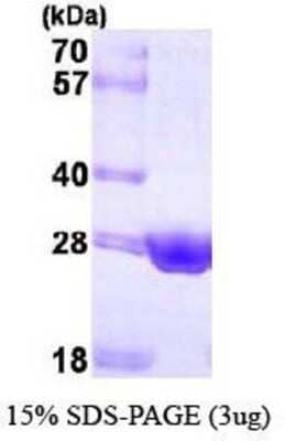 SDS-PAGE: Recombinant Human ERAB His Protein [NBP1-41148]