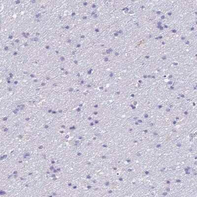 Immunohistochemistry-Paraffin: ERAF Antibody [NBP1-84008]