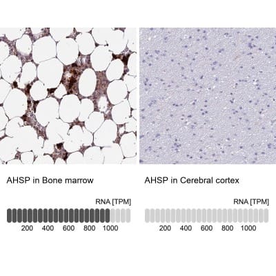 Immunohistochemistry-Paraffin: ERAF Antibody [NBP1-84008]