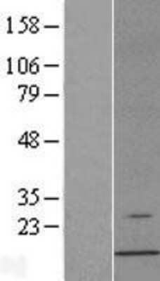 Western Blot: ERAF Overexpression Lysate [NBL1-10308]