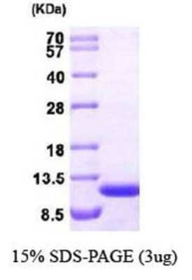 SDS-PAGE: Recombinant Human ERAF Protein [NBP1-30205]