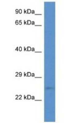 Western Blot: ERAS Antibody [NBP1-79602]