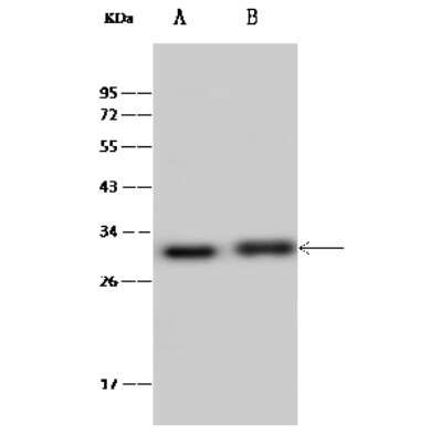 Western Blot: ERAS Antibody [NBP2-99426]