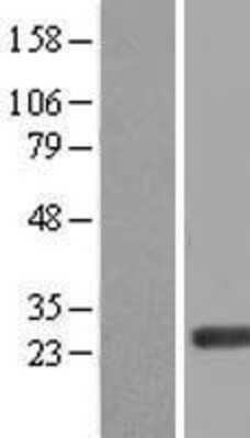 Western Blot: ERAS Overexpression Lysate [NBL1-10313]