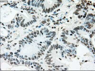 Immunohistochemistry-Paraffin: ERCC1 Antibody (OTI1A3) [NBP1-47733]