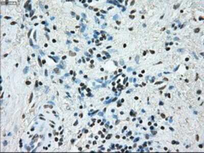 Immunohistochemistry-Paraffin: ERCC1 Antibody (OTI1A3) [NBP1-47733]